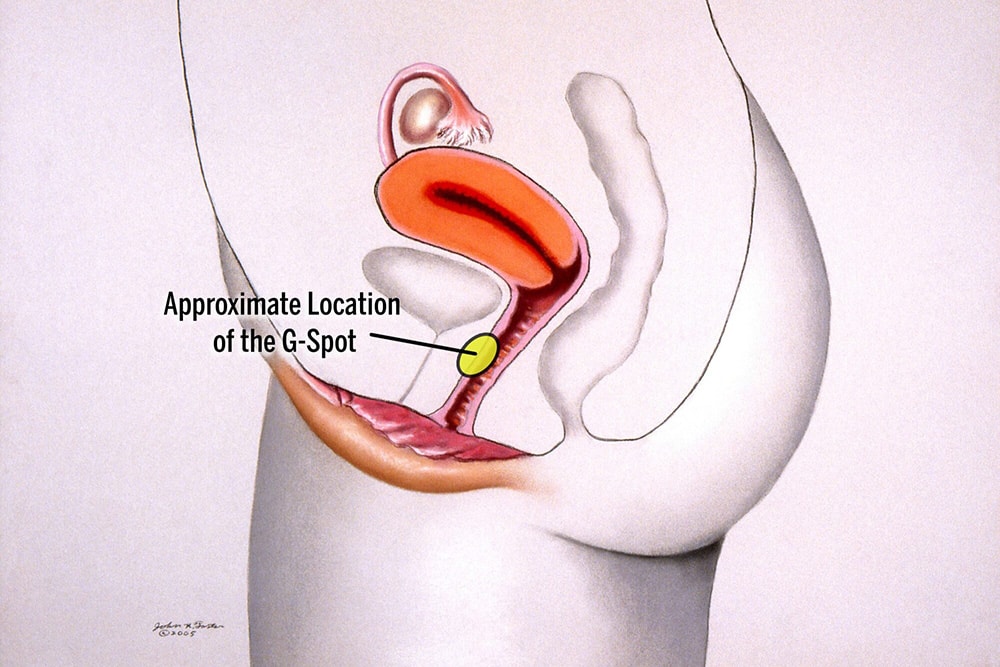 G spot injection Hyaluronic acid Geneva Dr Lucas