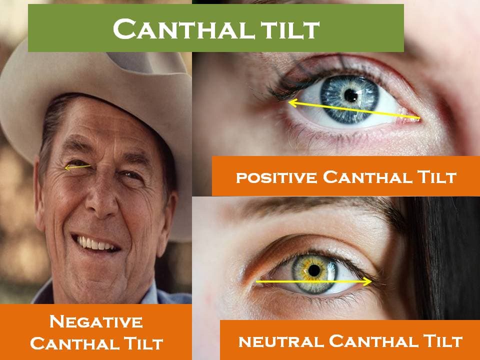 What is a canthal tilt?