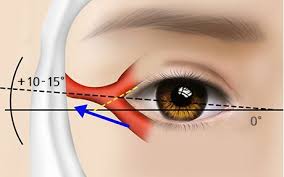 What is an Eye canthal Tilt? Why is a positive tilt more attractive than a  negative tilt among males? - PinkMirror Blog